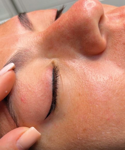 Permanent Eyeliner resultado 1