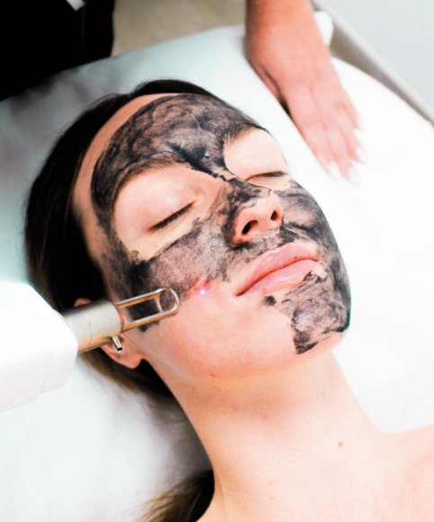 Hollywood Peeling resultado 1